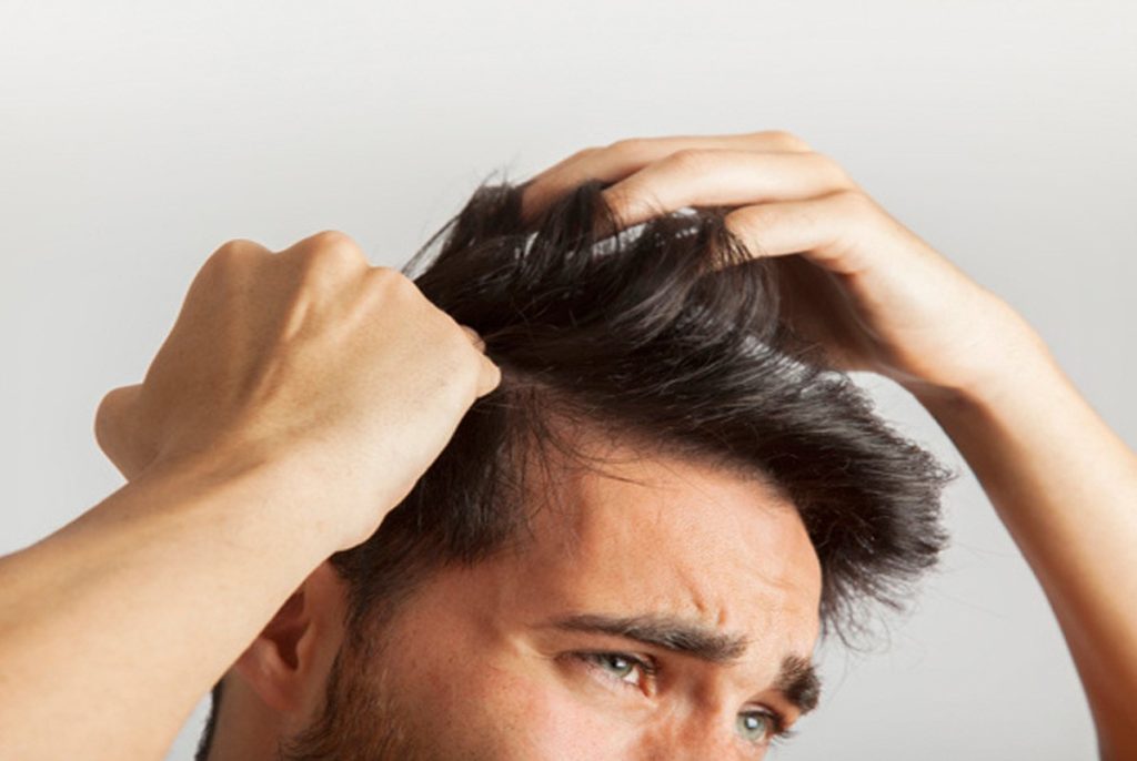 درمان شوره و ریزش مو با روغن کندور